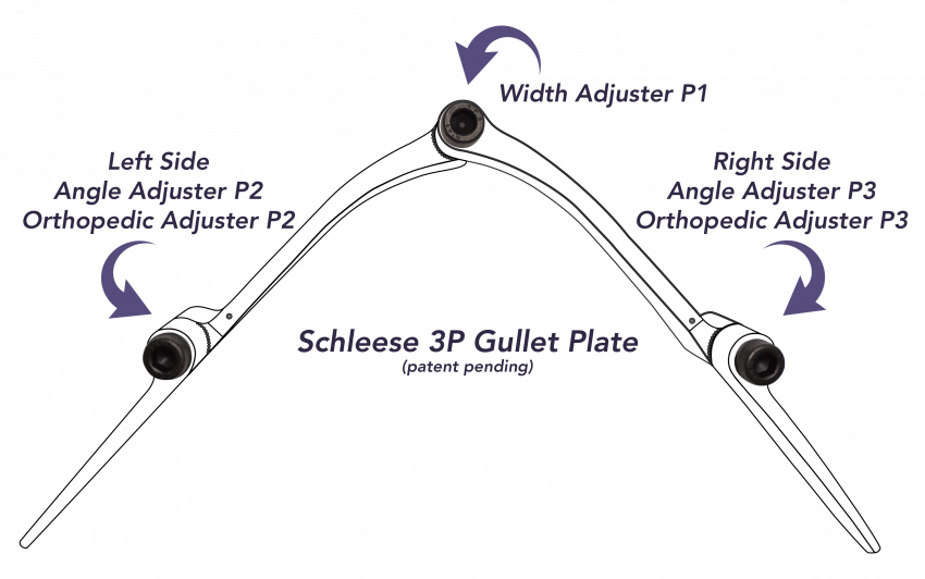Schleese 3P Gullet Plate - U.S. Patent [11377343]