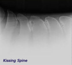 X-Ray of Kissing Spine in a horse.